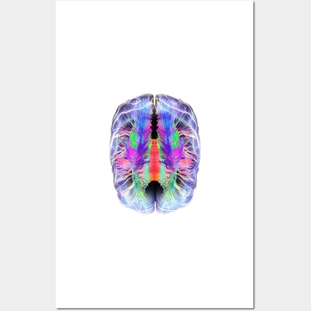 White matter fibres and brain, artwork (C028/6324) Wall Art by SciencePhoto